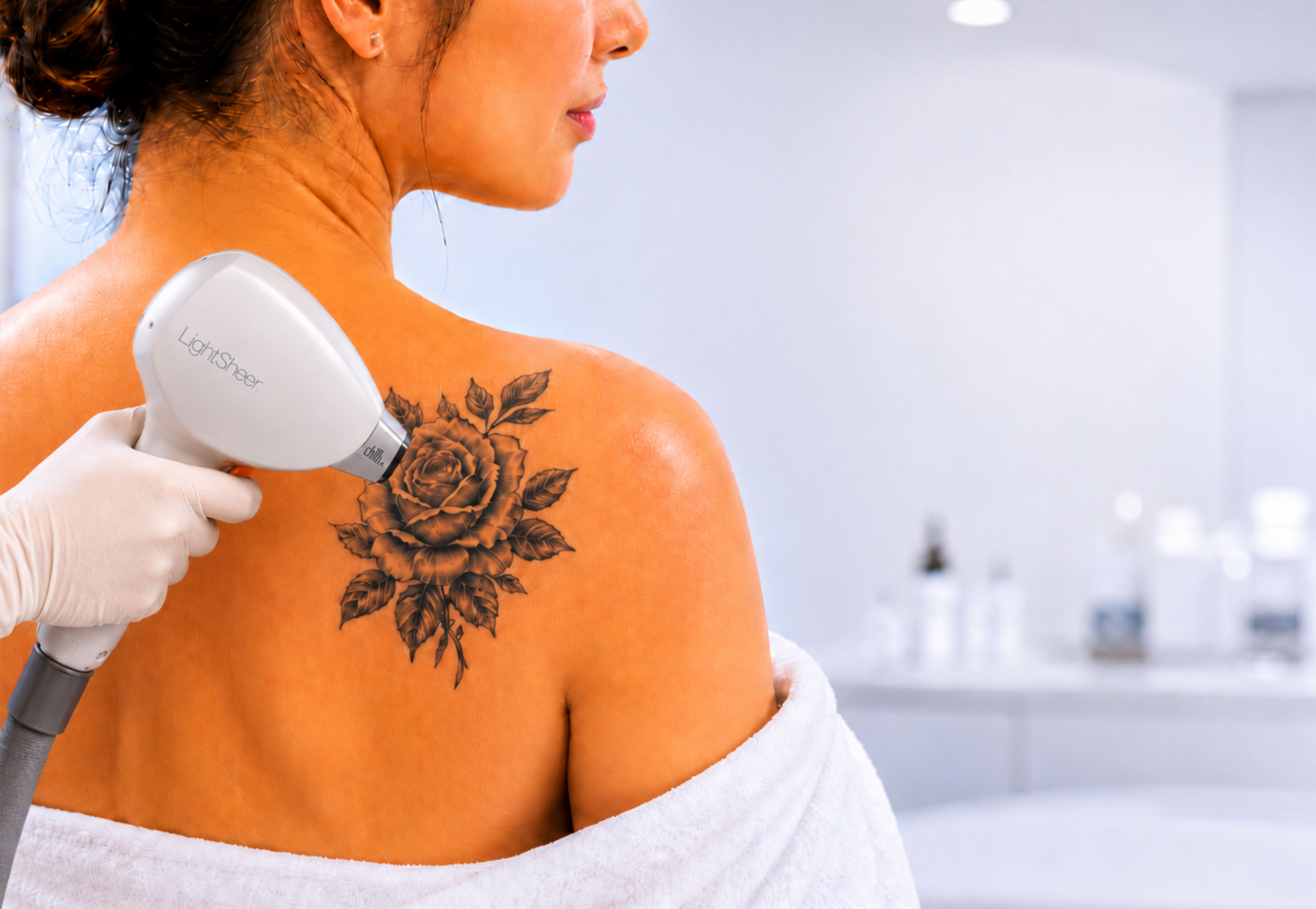 Tattoo Removal Without Scars in Rohini Delhi
